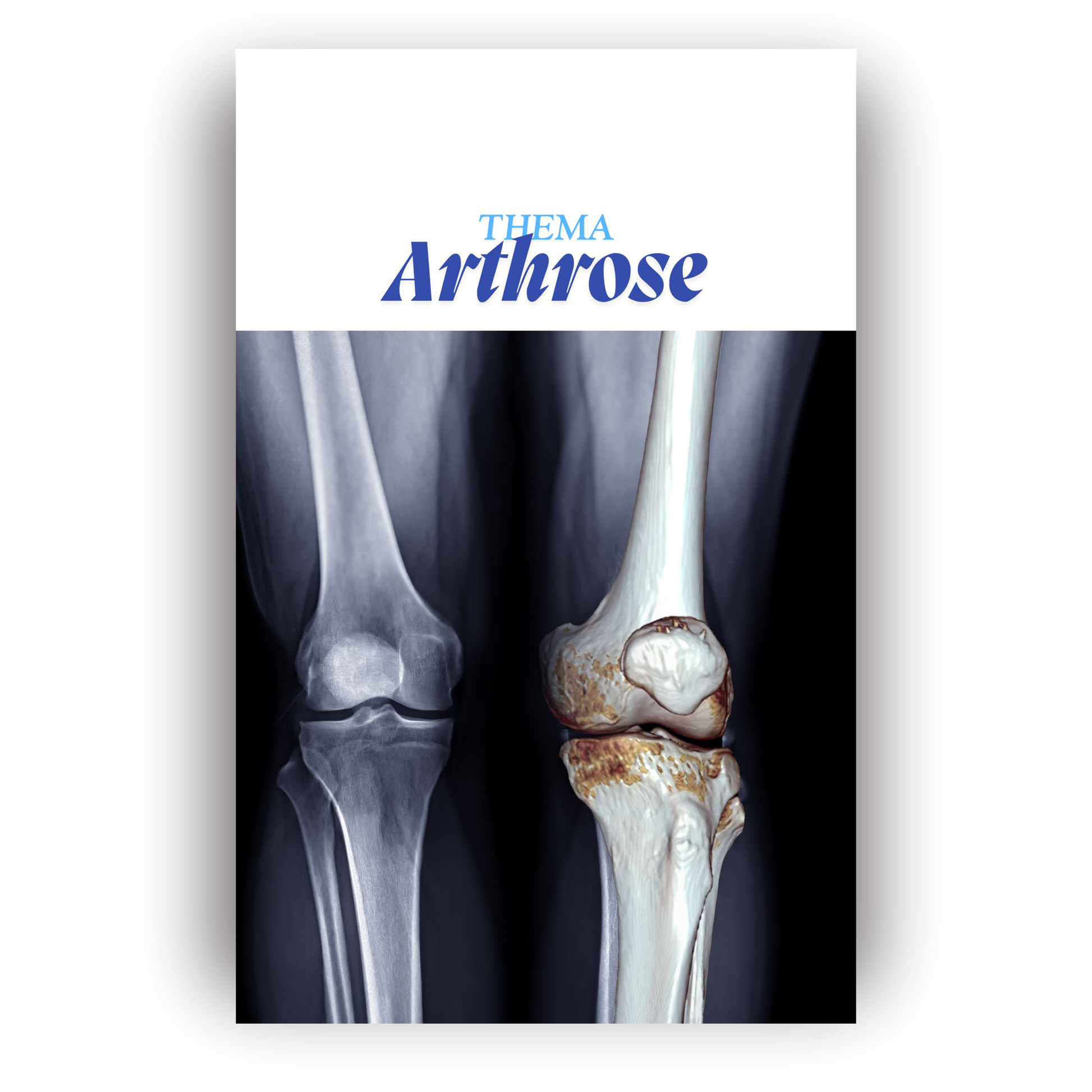 Arthrose kompakt für Auszubildende – PDF Lernbuch
