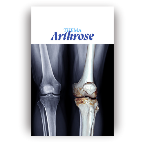 Arthrose kompakt für Auszubildende – PDF Lernbuch