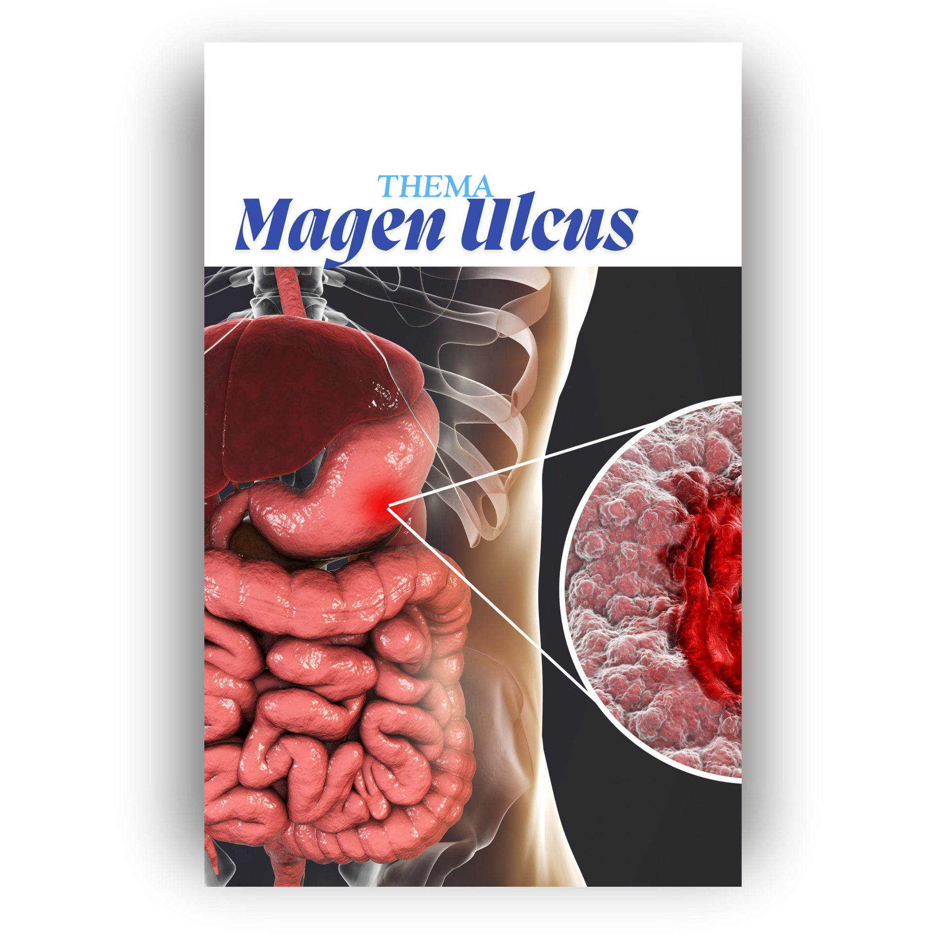 Magen Ulcus kompakt – Pflegewissen für Azubis (PDF-Version zum Download)