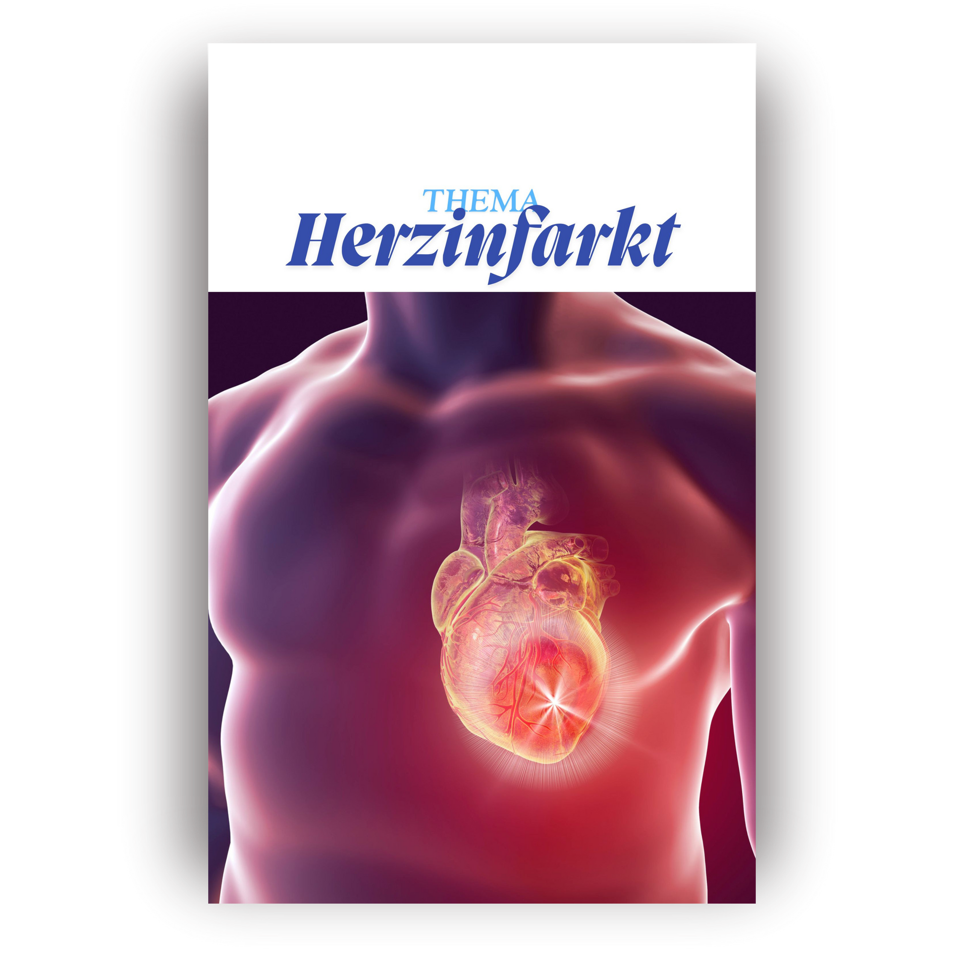 Herzinfarkt kompakt – (PDF)