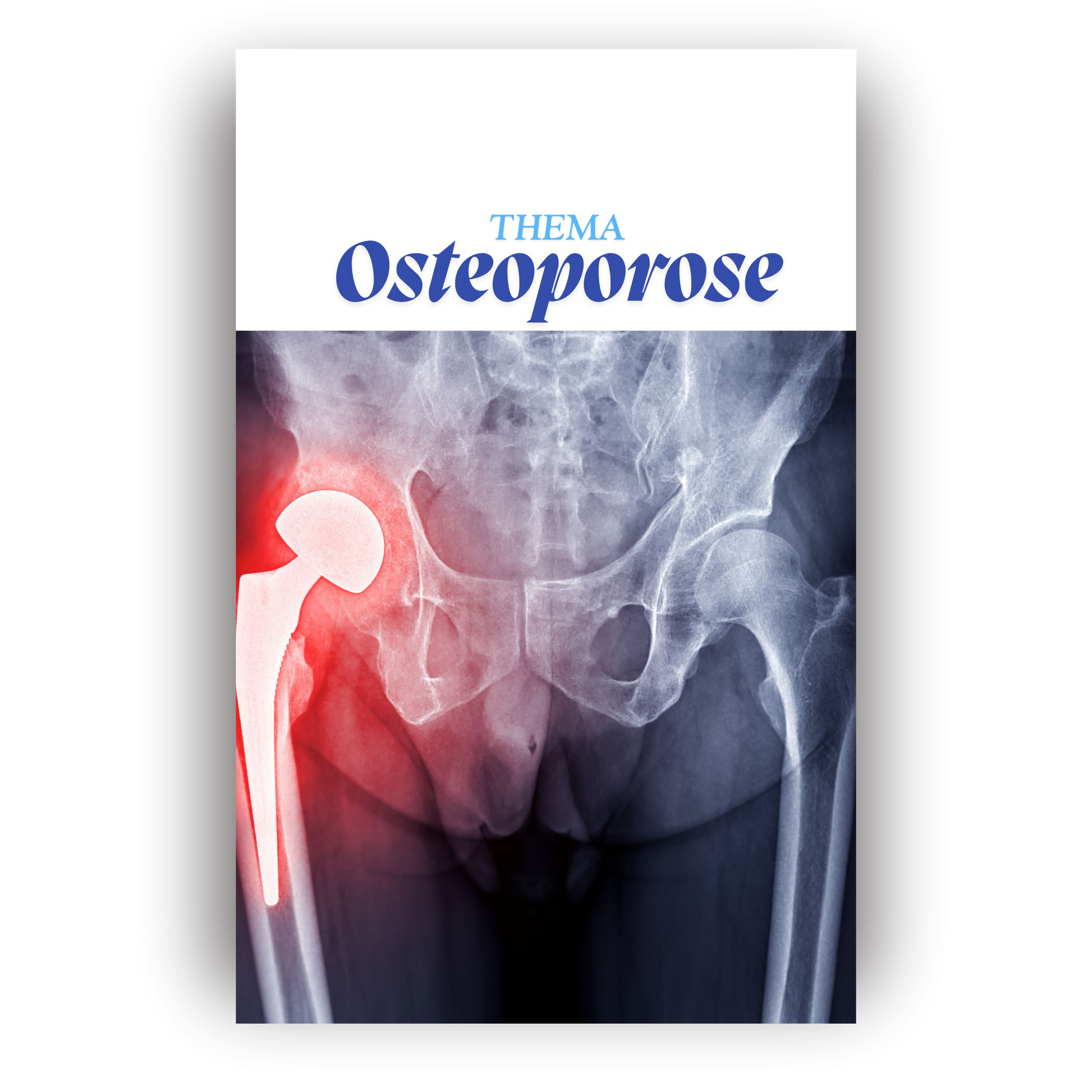 Osteoporose kompakt für Pflegekräfte – PDF-Handbuch